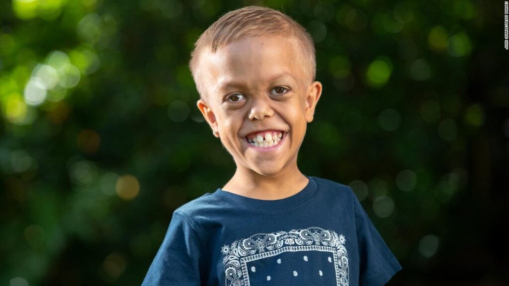 bullied-boy-with-dwarfism-scores-role-in-new-‘mad-max’-movie