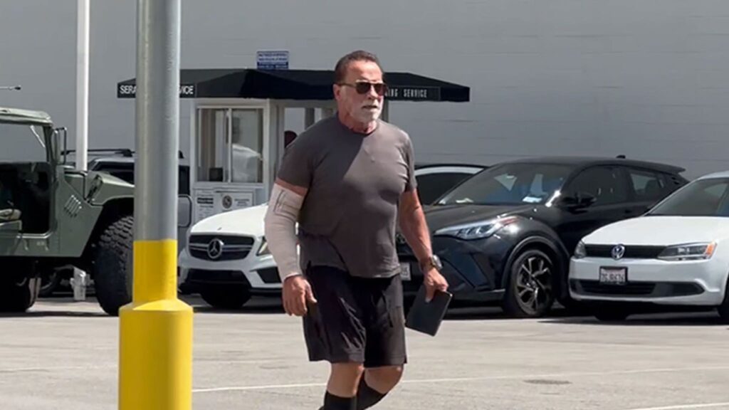 arnold-schwarzenegger-sporting-arm-cast-after-undergoing-elbow-surgery