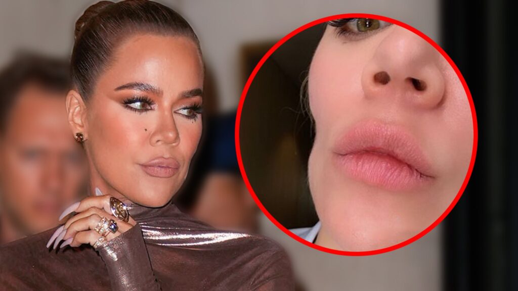 khloe-kardashian-shares-skin-cancer-journey,-reveals-face-indentation