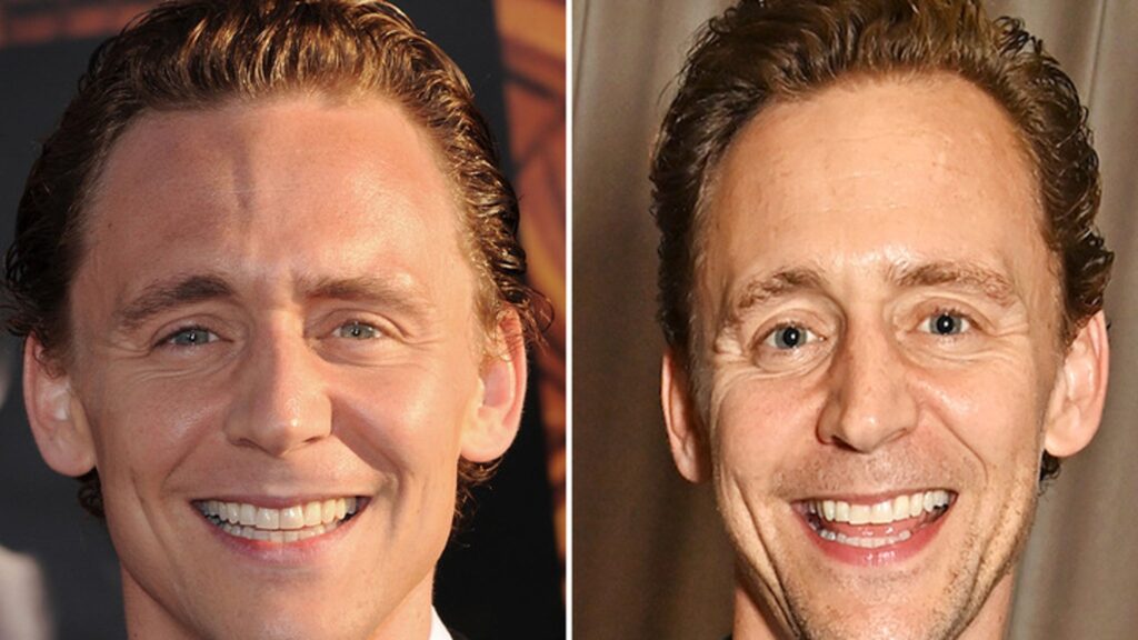 tom-hiddleston-—-good-genes-or-good-docs?!