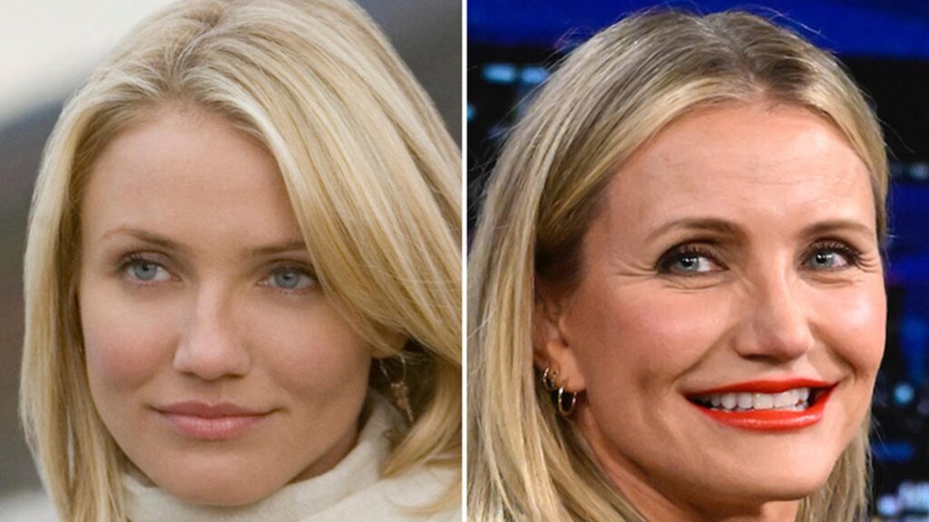 cameron-diaz-—-good-genes-or-good-docs?!