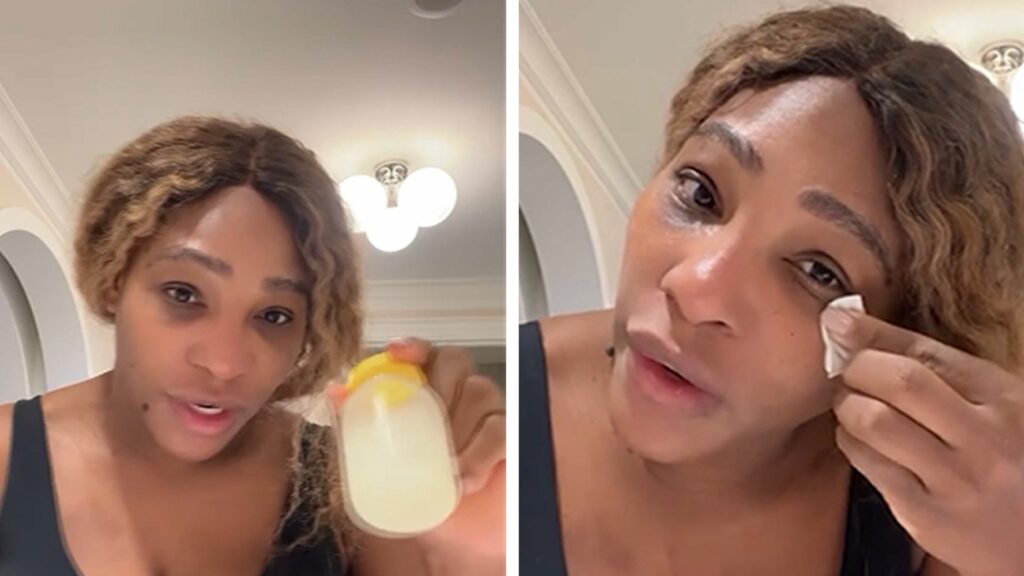 serena-williams-says-her-breast-milk-helped-heal-her-facial-sunburns
