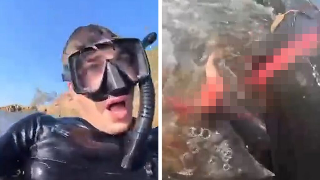 man-films-aftermath-of-shark-attack-that-claimed-his-leg-in-australia