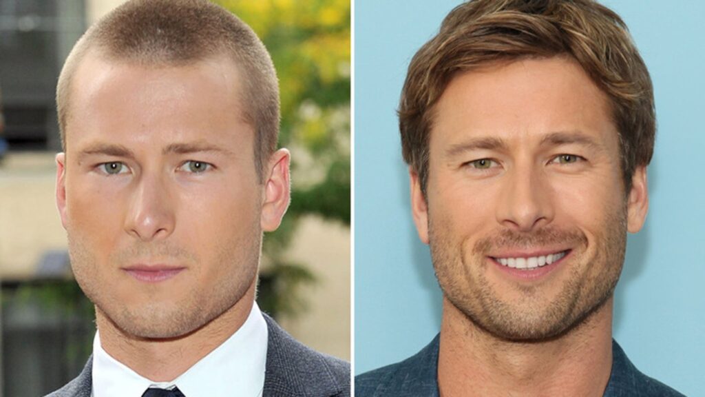 glenn-powell-—-good-genes-or-good-docs?!